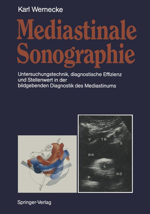 Produktbild: Mediastinale Sonographie
