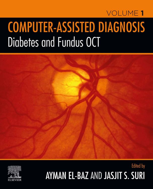 Produktbild: Diabetes and Fundus OCT