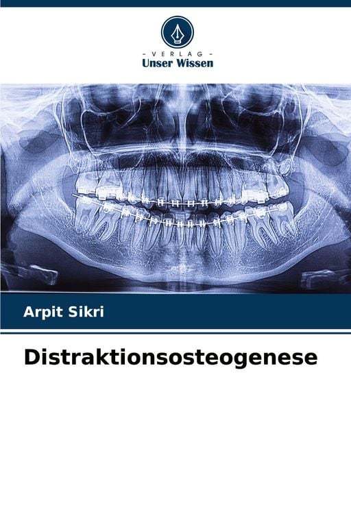 Produktbild: Distraktionsosteogenese
