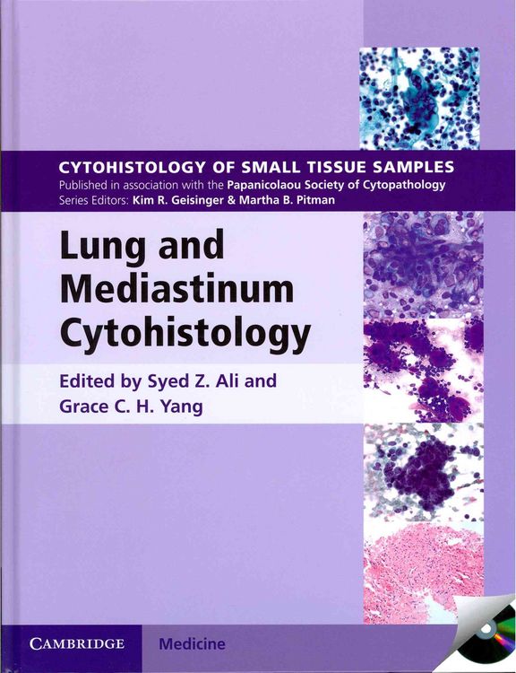 Produktbild: Lung and Mediastinum Cytohistology