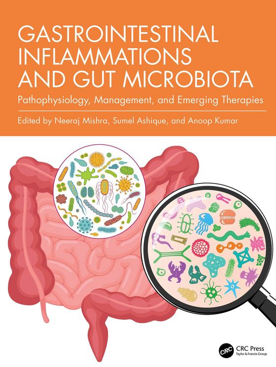 Produktbild: Gastrointestinal Inflammations and Gut Microbiota