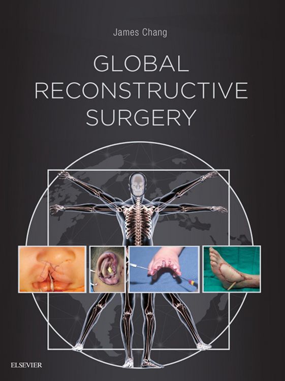 Produktbild: Global Reconstructive Surgery