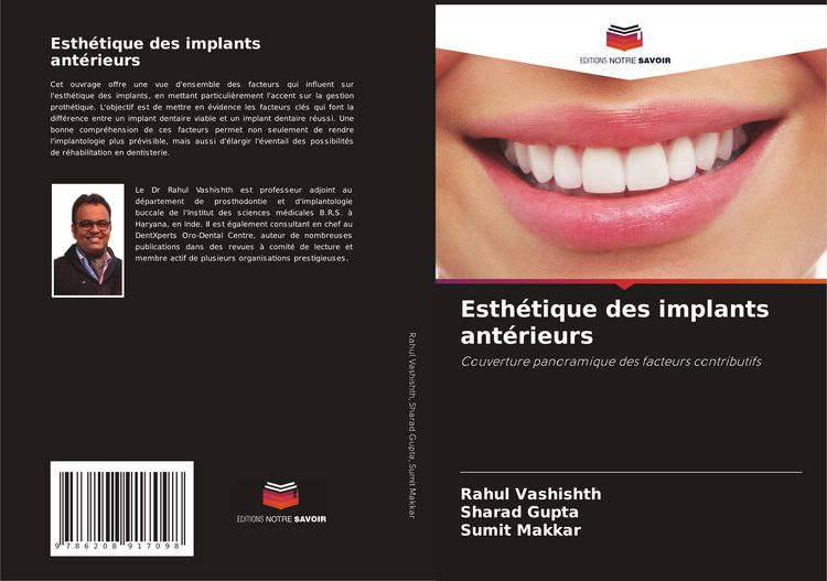 Produktbild: Esth&eacute;tique des implants ant&eacute;rieurs