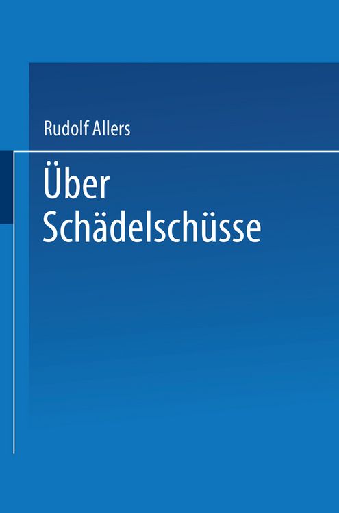 Produktbild: &Uuml;ber Sch&auml;delsch&uuml;sse
