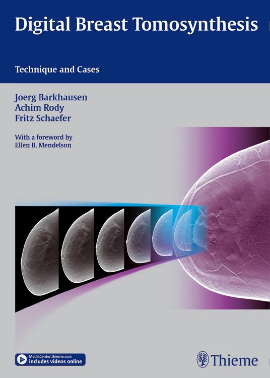 Produktbild: Digital Breast Tomosynthesis