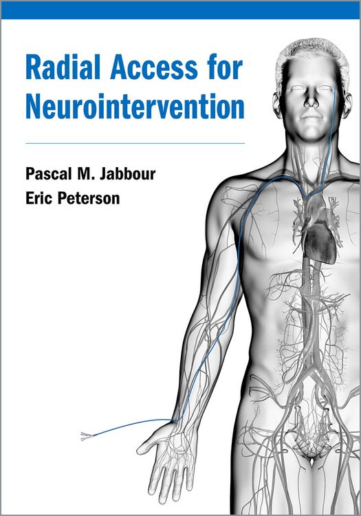Produktbild: Radial Access for Neurointervention