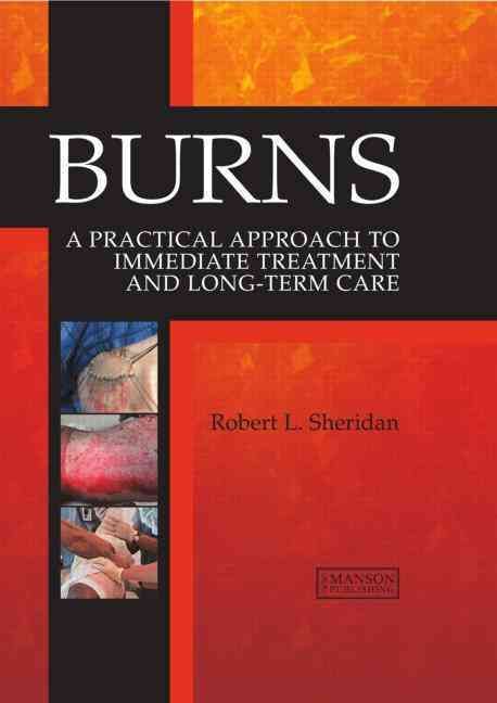 Produktbild: BURNS