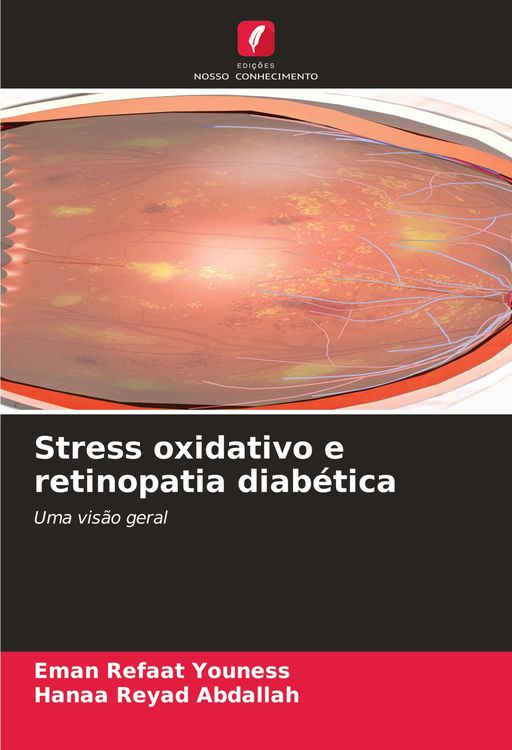 Produktbild: Stress oxidativo e retinopatia diab&eacute;tica