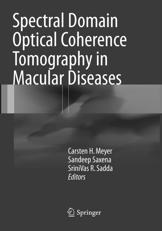 Produktbild: Spectral Domain Optical Coherence Tomography in Macular Diseases