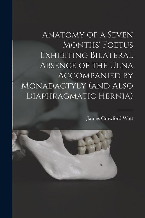 Produktbild: Anatomy of a Seven Months' Foetus Exhibiting Bilateral Absence of the Ulna Accompanied by Monadactyly (and Also Diaphragmatic Hernia) [microform]