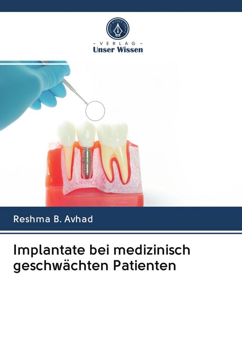 Produktbild: Implantate bei medizinisch geschw&auml;chten Patienten
