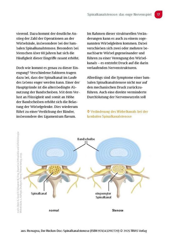 Produktbild: Der R&uuml;cken-Doc: Spinalkanalstenose