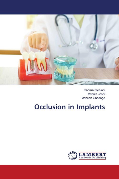 Produktbild: Occlusion in Implants