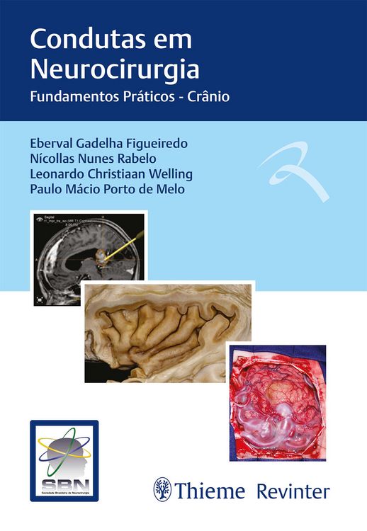 Produktbild: Condutas em Neurocirurgia