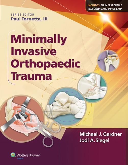 Produktbild: Minimally Invasive Orthopaedic