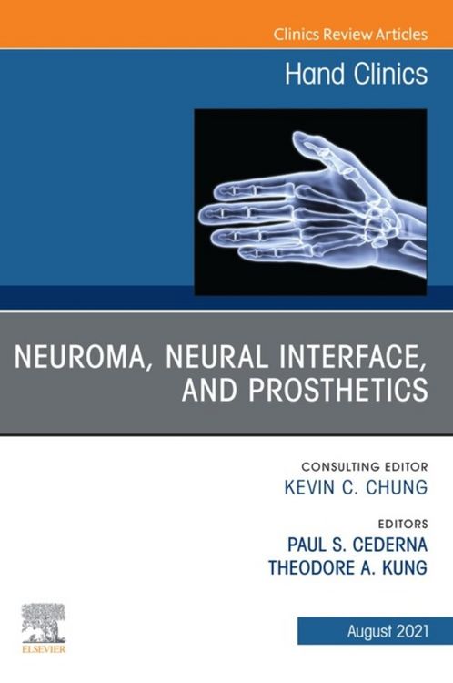 Produktbild: Neuroma, Neural interface, and Prosthetics, An Issue of Hand Clinics, E-Book