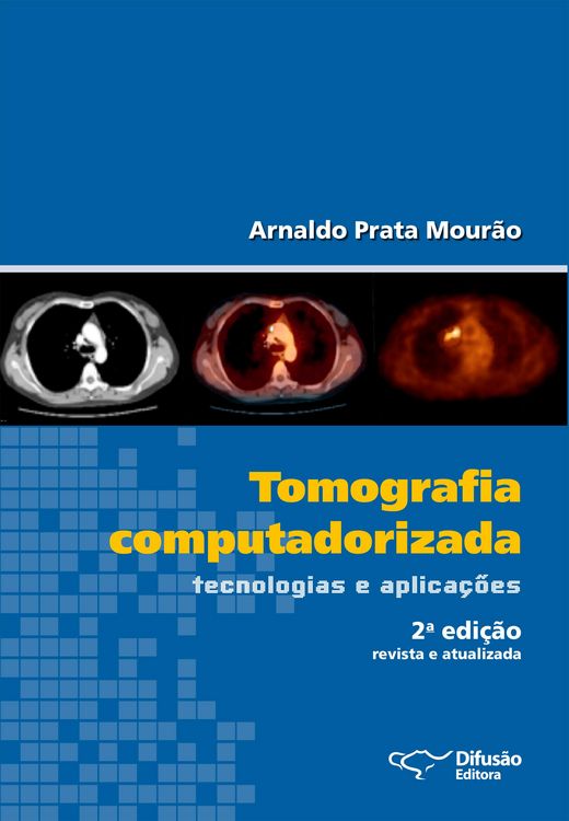 Produktbild: Tomografia computadorizada