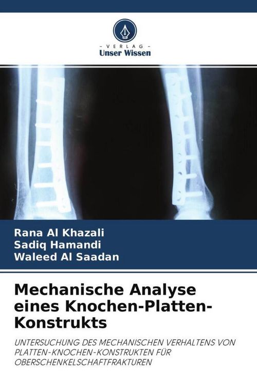 Produktbild: Mechanische Analyse eines Knochen-Platten-Konstrukts