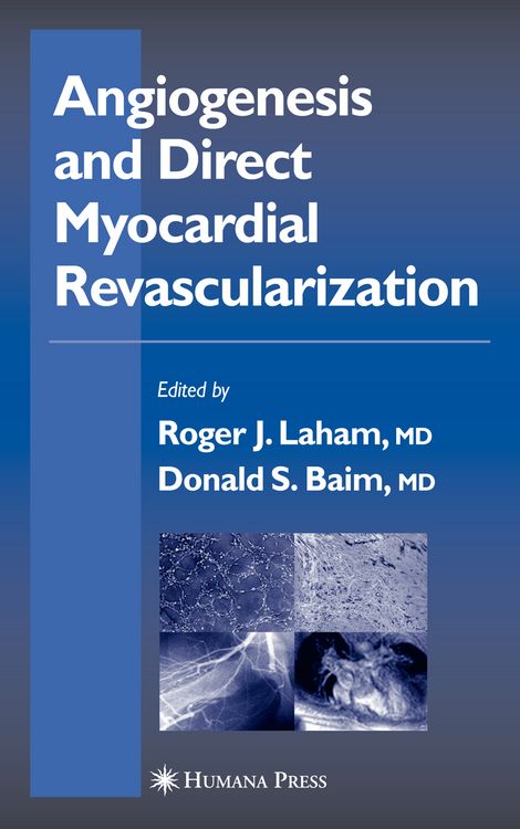 Produktbild: Angiogenesis and Direct Myocardial Revascularization