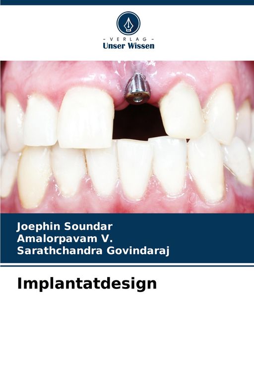 Produktbild: Implantatdesign