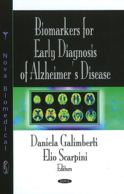 Produktbild: Biomarkers for Early Diagnosis of Alzheimer's Disease