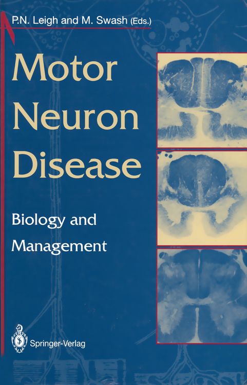 Produktbild: Motor Neuron Disease