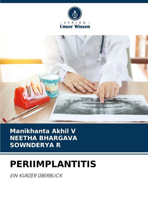 Produktbild: Periimplantitis