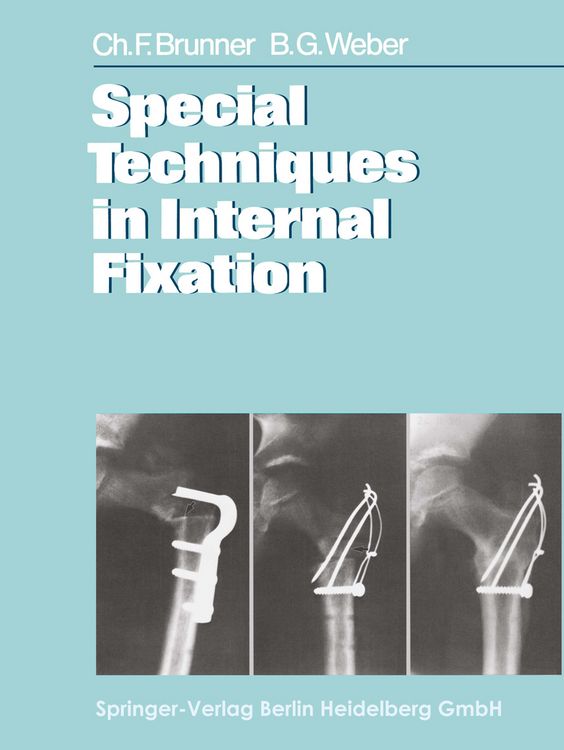 Produktbild: Special Techniques in Internal Fixation