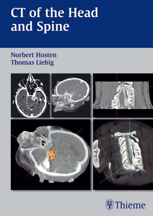 Produktbild: CT of the Head and Spine