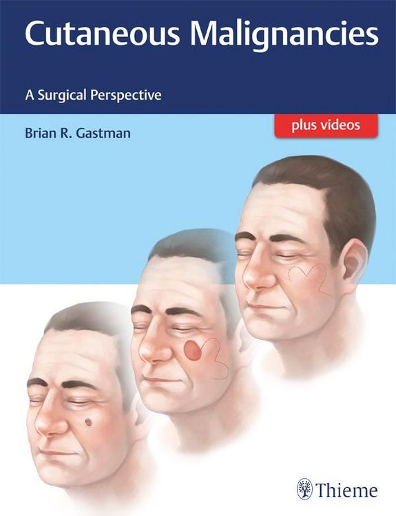 Produktbild: Cutaneous Malignancies
