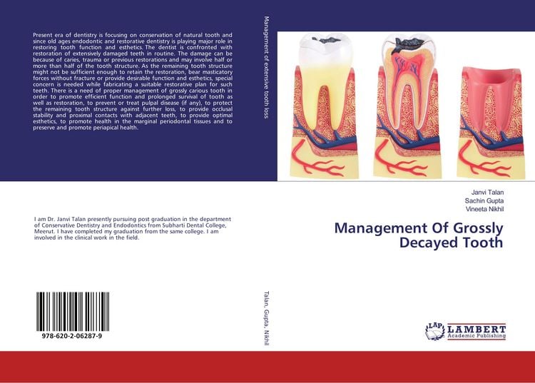 Produktbild: Management Of Grossly Decayed Tooth