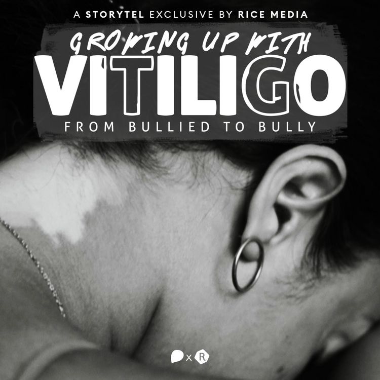 Produktbild: Growing Up With Vitiligo, I Was Bullied&mdash;Until I Became A Bully