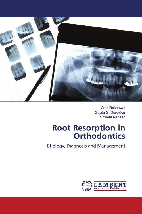 Produktbild: Root Resorption in Orthodontics