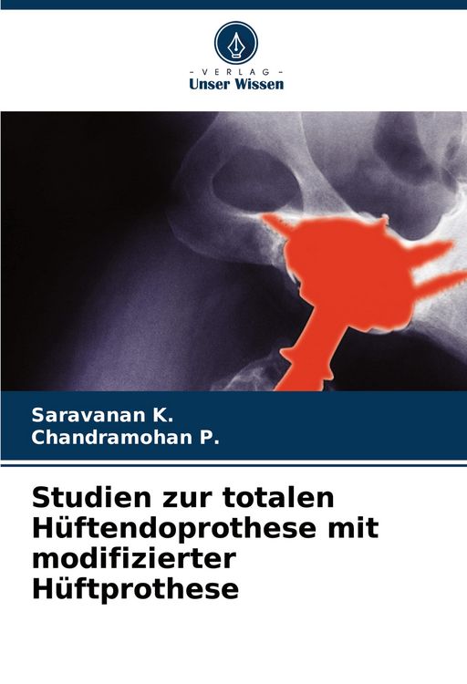 Produktbild: Studien zur totalen H&uuml;ftendoprothese mit modifizierter H&uuml;ftprothese