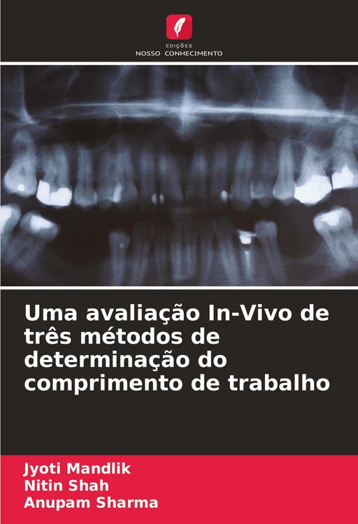 Produktbild: Uma avalia&ccedil;&atilde;o In-Vivo de tr&ecirc;s m&eacute;todos de determina&ccedil;&atilde;o do comprimento de trabalho