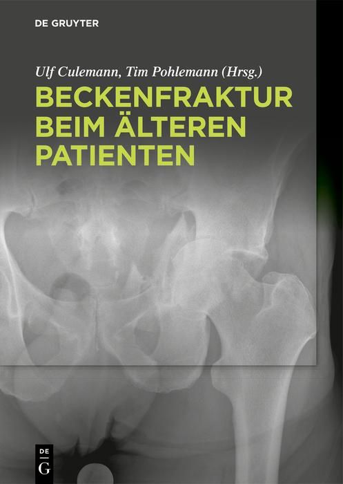 Produktbild: Beckenfraktur beim &auml;lteren Patienten