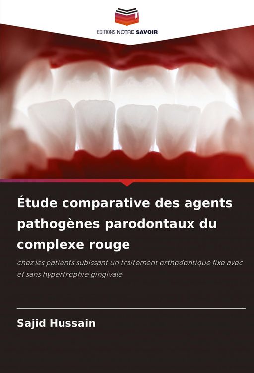 Produktbild: &Eacute;tude comparative des agents pathog&egrave;nes parodontaux du complexe rouge