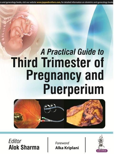 Produktbild: A Practical Guide to Third Trimester of Pregnancy & Puerperium