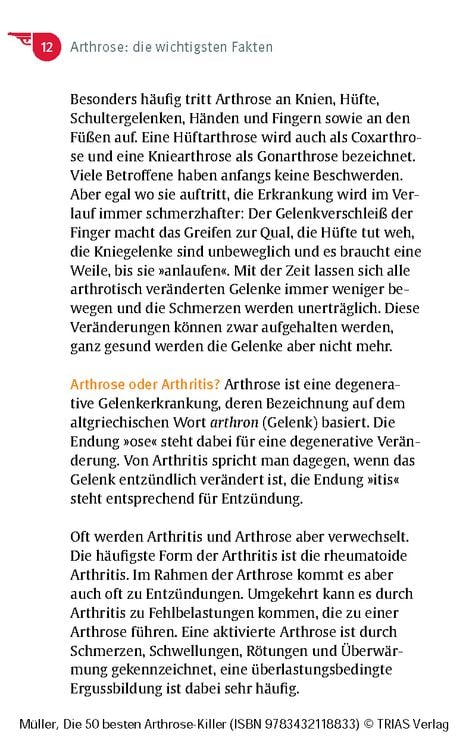 Produktbild: Die 50 besten Arthrose-Killer