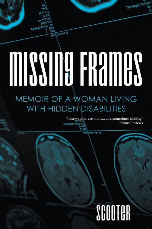 Produktbild: Missing Frames