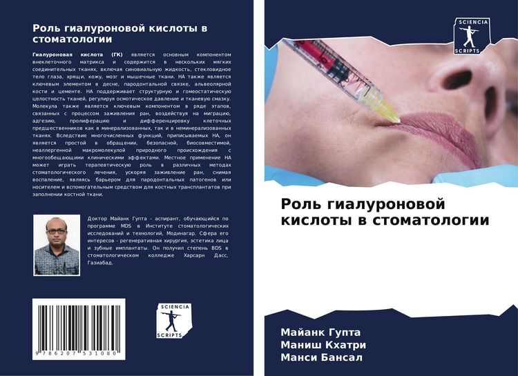 Produktbild: Rol' gialuronowoj kisloty w stomatologii