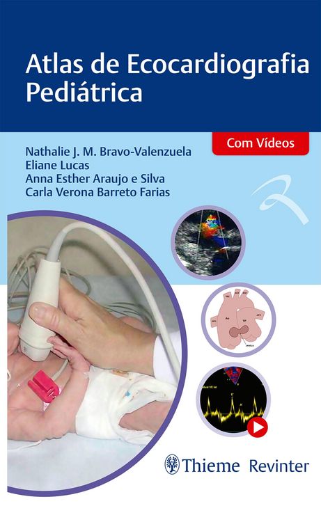 Produktbild: Atlas de Ecocardiografia Pedi&aacute;trica