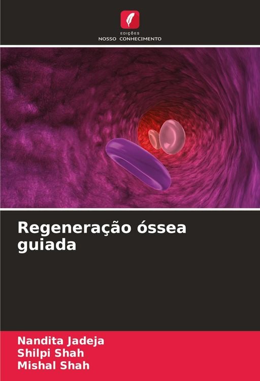 Produktbild: Regenera&ccedil;&atilde;o &oacute;ssea guiada