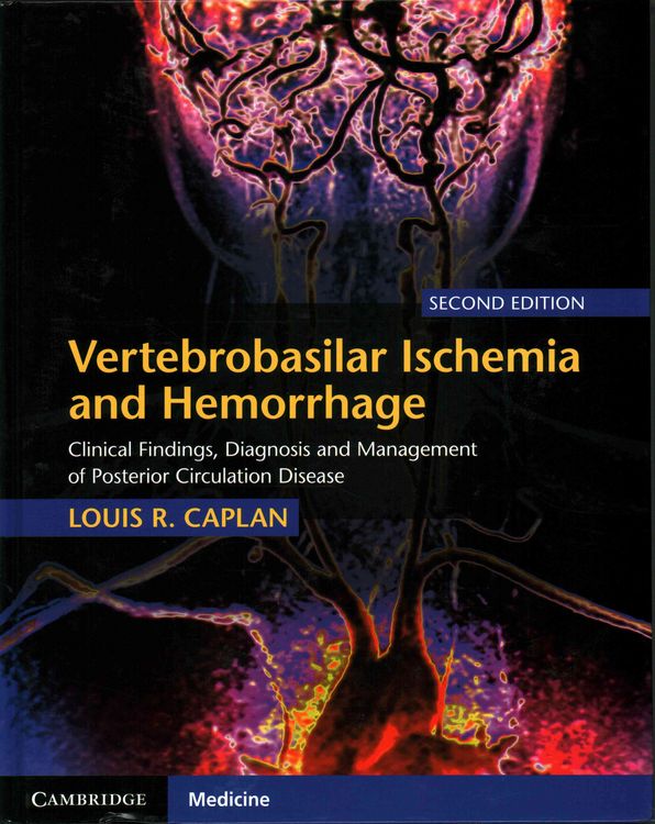 Produktbild: Vertebrobasilar Ischemia and Hemorrhage