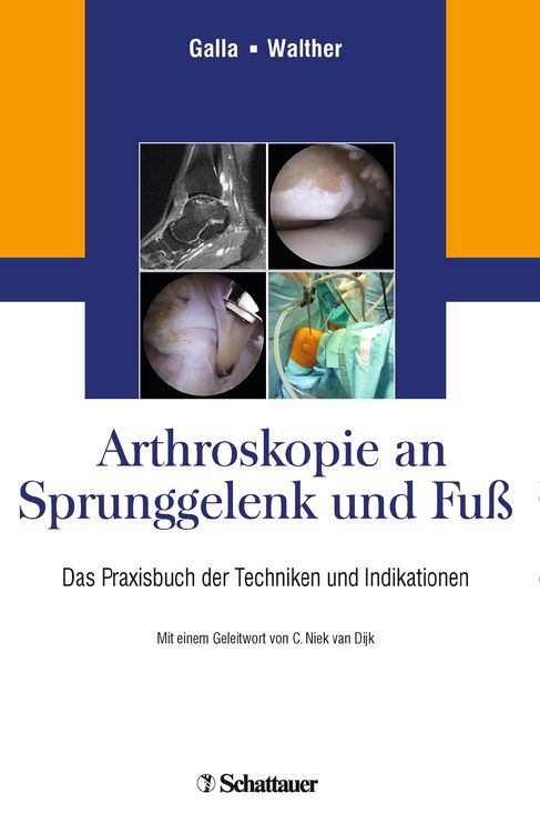 Produktbild: Arthroskopie an Sprunggelenk und Fu&szlig;