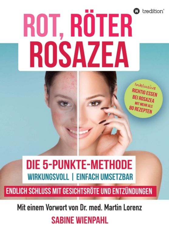 Produktbild: Rot R&ouml;ter Rosazea
