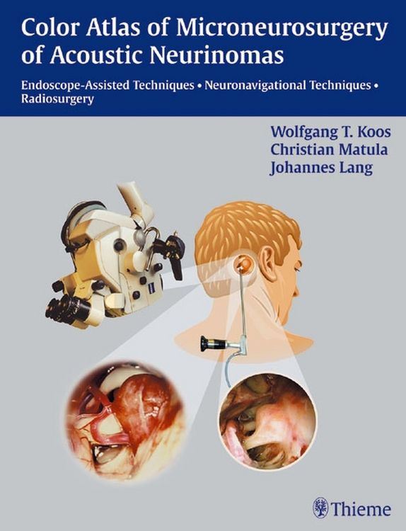 Produktbild: Color Atlas of Microsurgery of Acoustic Neurinomas