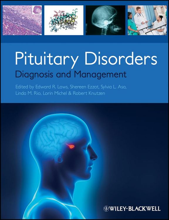Produktbild: Pituitary Disorders