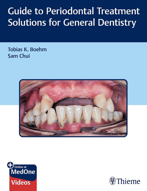 Produktbild: Guide to Periodontal Treatment Solutions for General Dentistry