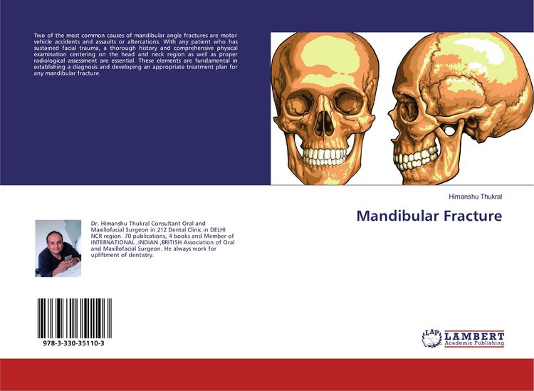 Produktbild: Mandibular Fracture